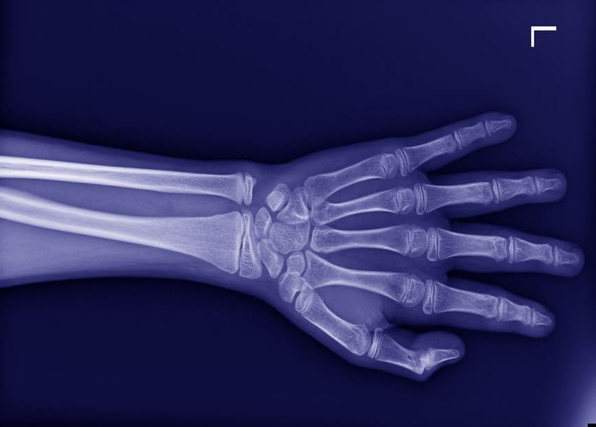 radiographie de la main 1